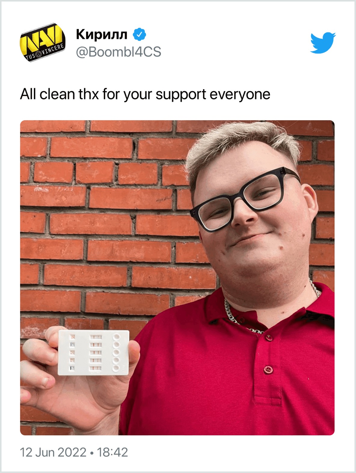 Boombl4 shares a drug test